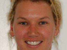 Case 2 OrthoCos After