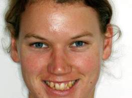 Case 2 OrthoCos Before