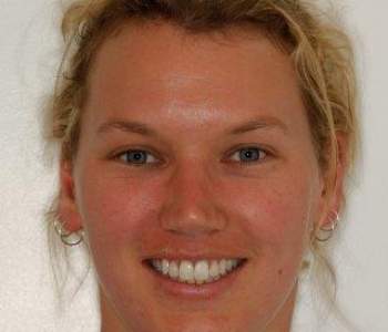 Case 2 OrthoCos After