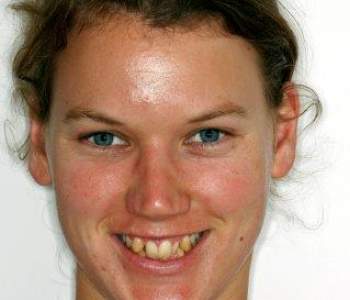 Case 2 OrthoCos Before